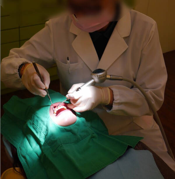 姓男子只有国中学历跟齿磨师资历,却当冒牌牙医28年,帮人换假牙。示意图,与本新闻无关。(资料照)
姓男子只有国中学历跟齿磨师资历,却当冒牌牙医28年,帮人换假牙。示意图,与本新闻无关。(资料照)