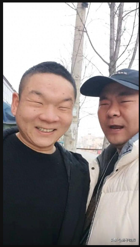 常被嘲睁眼跟闭眼一样 眯眯眼大叔动刀开眼