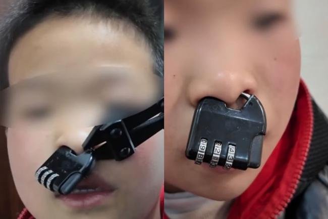 中国熊孩子“密码锁卡鼻” 消防员当面吐槽 中国熊孩子“密码锁卡鼻” 消防员当面吐槽