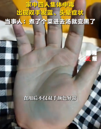 ▲手变蓝色。 （图/翻摄自微博）