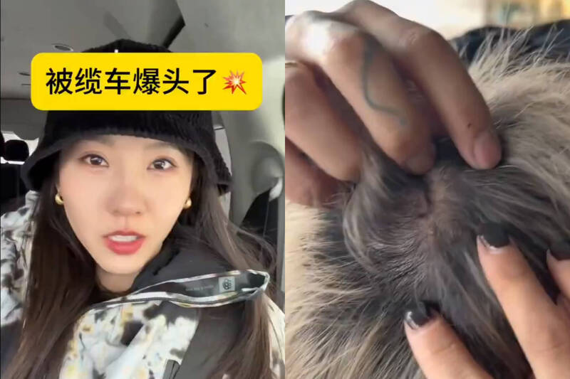 中國遊客到日本滑雪顧著聊天拍照,被雪場纜車撞傷頭部。(本報合成,擷取自X) 中国游客到日本滑雪顾着聊天拍照,被雪场缆车撞伤头部。 (本报合成,撷取自X)