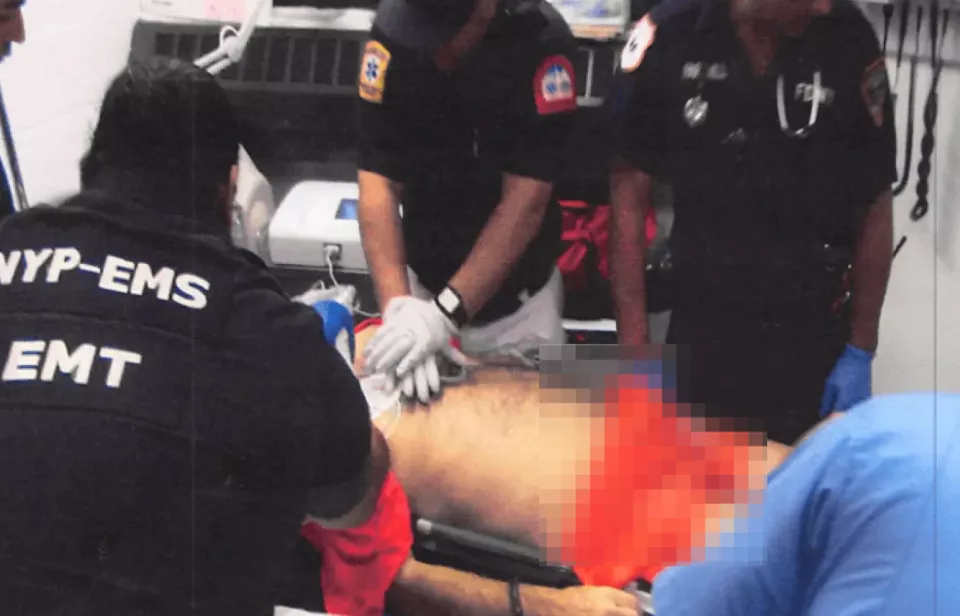 爱泼斯坦“自缢”后照片首度公开:喉部甲状软骨断裂