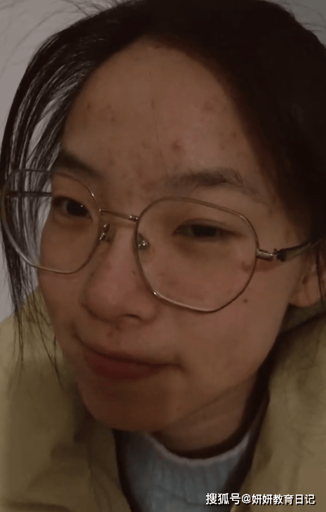 大二女孩发视频,脸上全是被家长亏待的痕迹 大二女孩发视频,脸上全是被家长亏待的痕迹
