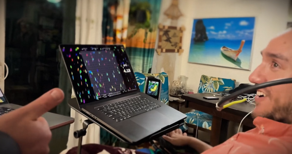 已致114伤1死，中国企业的血糖仪遭FDA警告