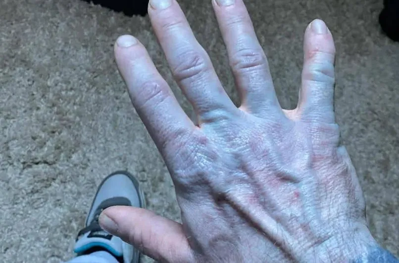 他全身发蓝，被紧急送医！真相曝光 网民惊呆