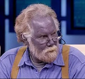 他全身发蓝，被紧急送医！真相曝光 网民惊呆