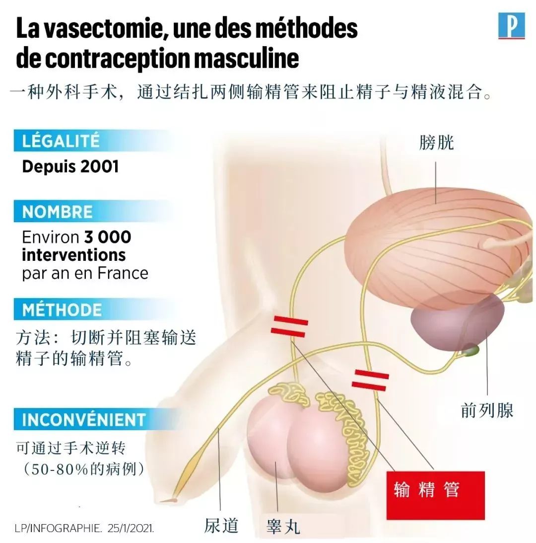 一年50万男人结扎，这个月特别多